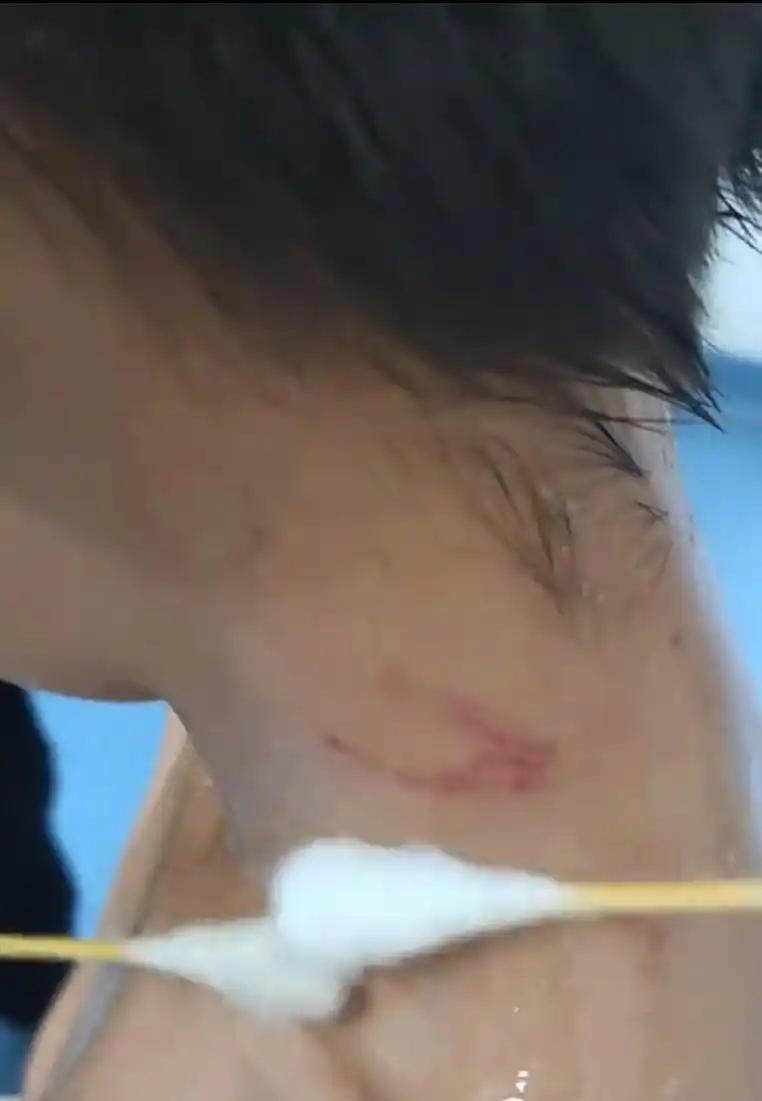一7岁男孩去看猴子，一个动作却引来猴子全家殴打，男孩瞬间被吓得大哭。网友：连猴子