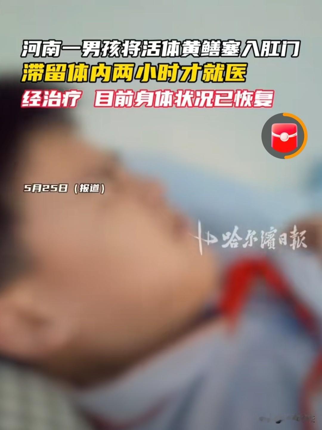 河南商丘，一个14岁男孩为了刺激，把一条活黄鳝塞进l了肛门内，之后黄鳝就开始往