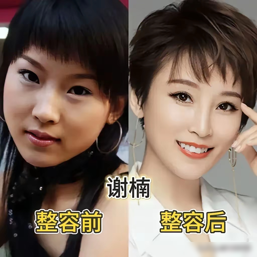 沈梦辰那张脸，真是一步一步换出来的。当年模特比赛出道，大圆脸，塌鼻梁，蒜头鼻，皮肤黑黄，扔人堆里找不