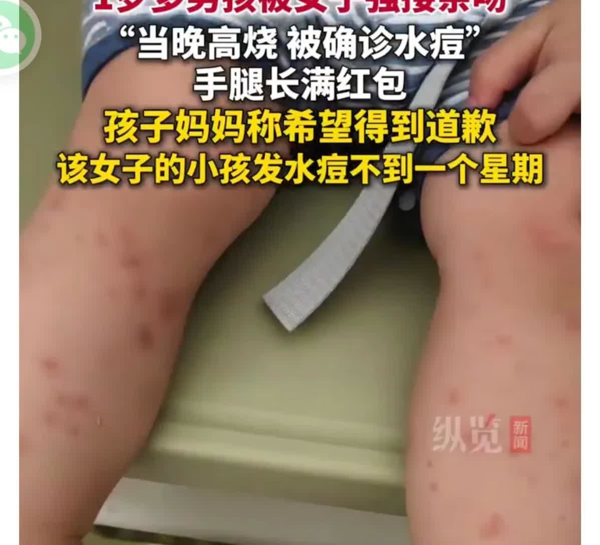 这种事情怎么能出这口恶气？事发湖南，这是故意传播疾病，如果她🉐艾滋病，周边就惨