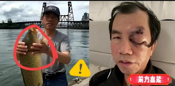 曾迷恋海外生活美好？一场遇袭让老人幡然醒悟，现实太刺骨！美国梦彻底破碎！七