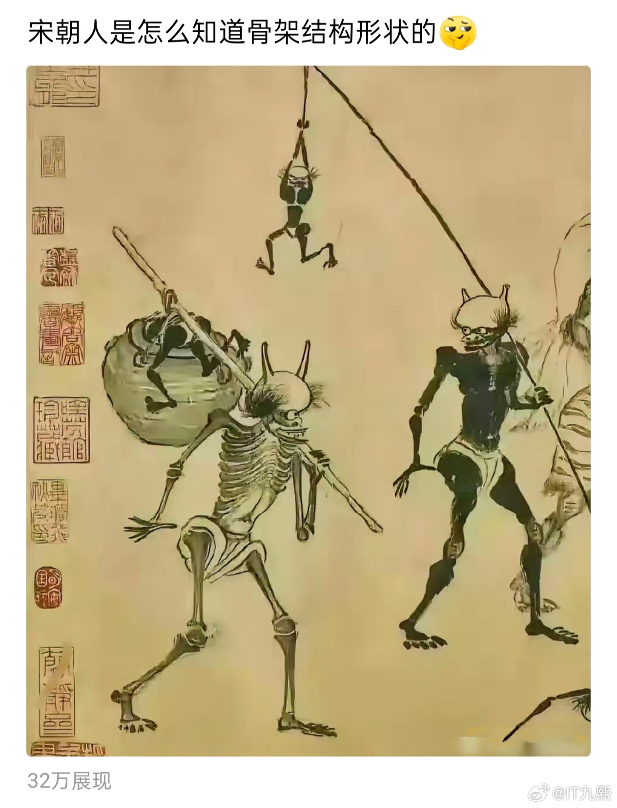 凌迟了解一下，不仅能知道骨架结构，还可以学习血管肌肉分布！[doge]​​​