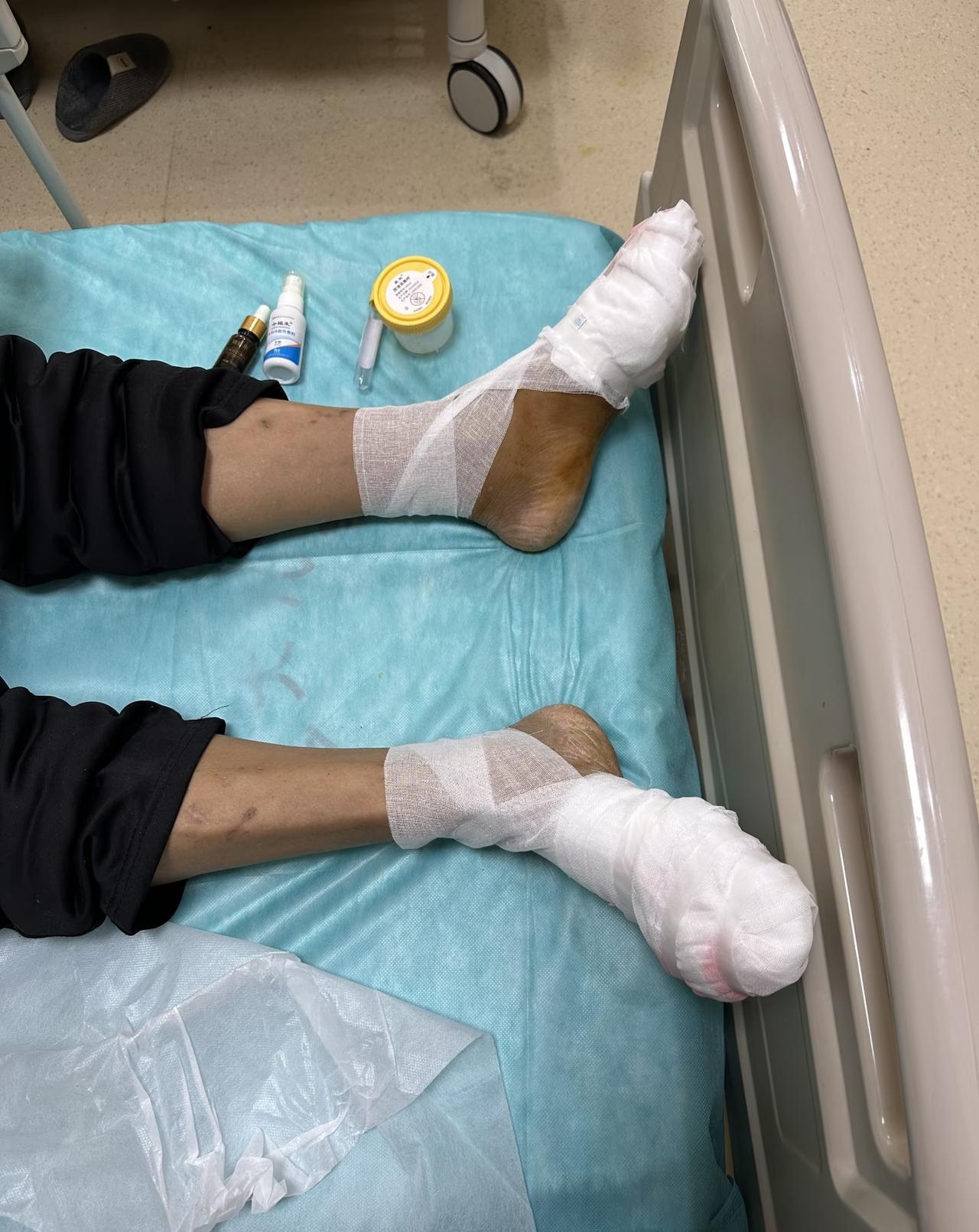 我有个同事，今年才33岁，她在22岁时就发现得了糖尿病，但从来不在乎，不忌口，饮