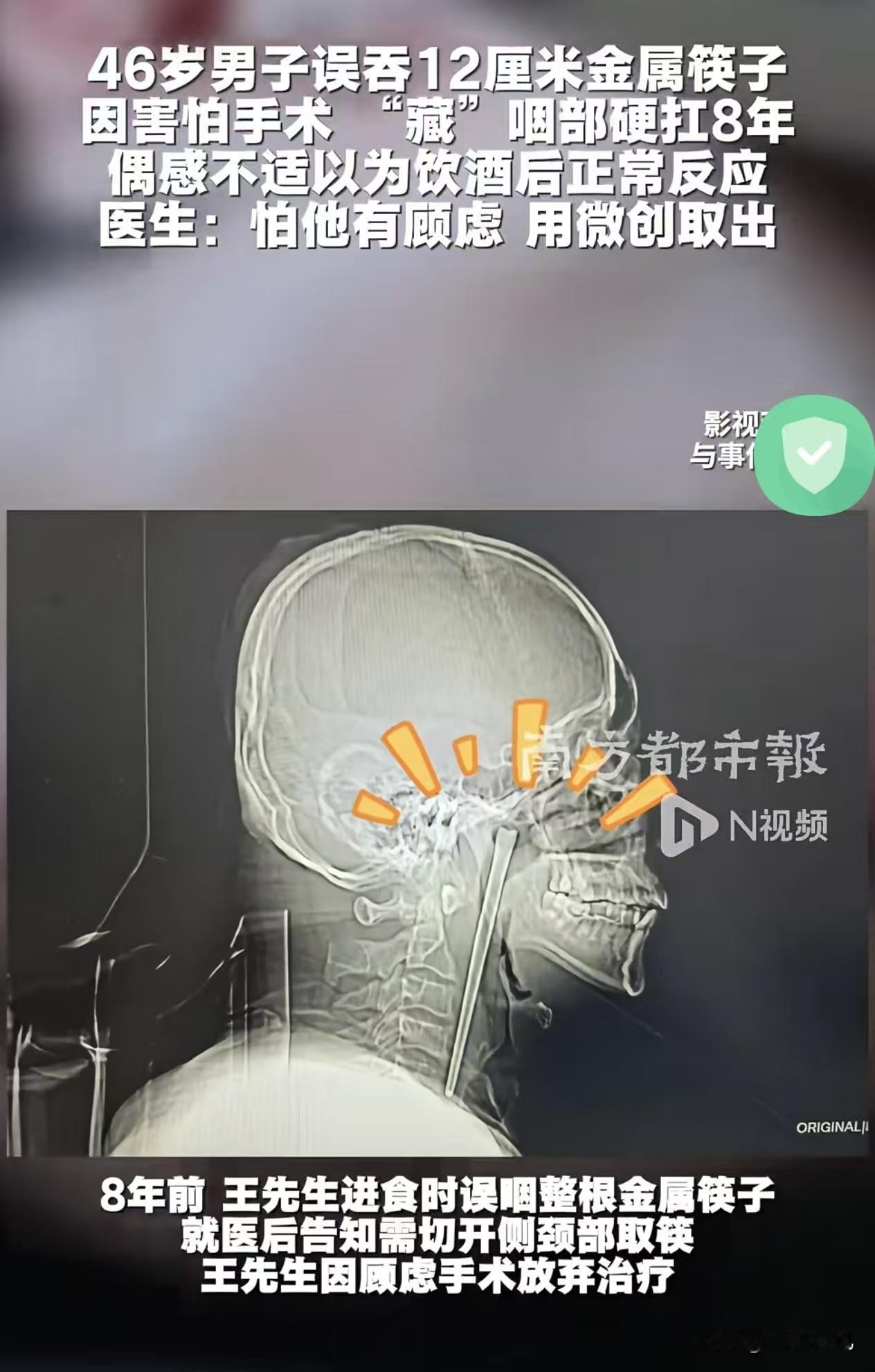 这哥们也太强了，我严重怀疑他这8年没想任何人低过头[捂脸哭]