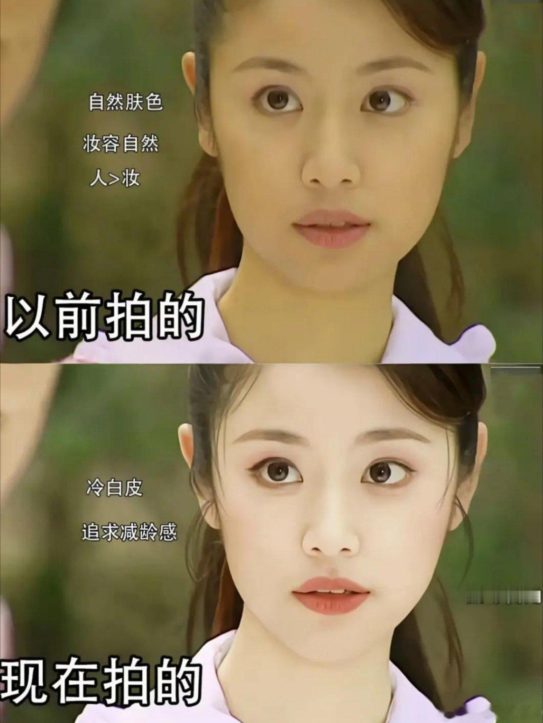 现在都不允许女明星脸上有瑕疵，有黑眼圈了