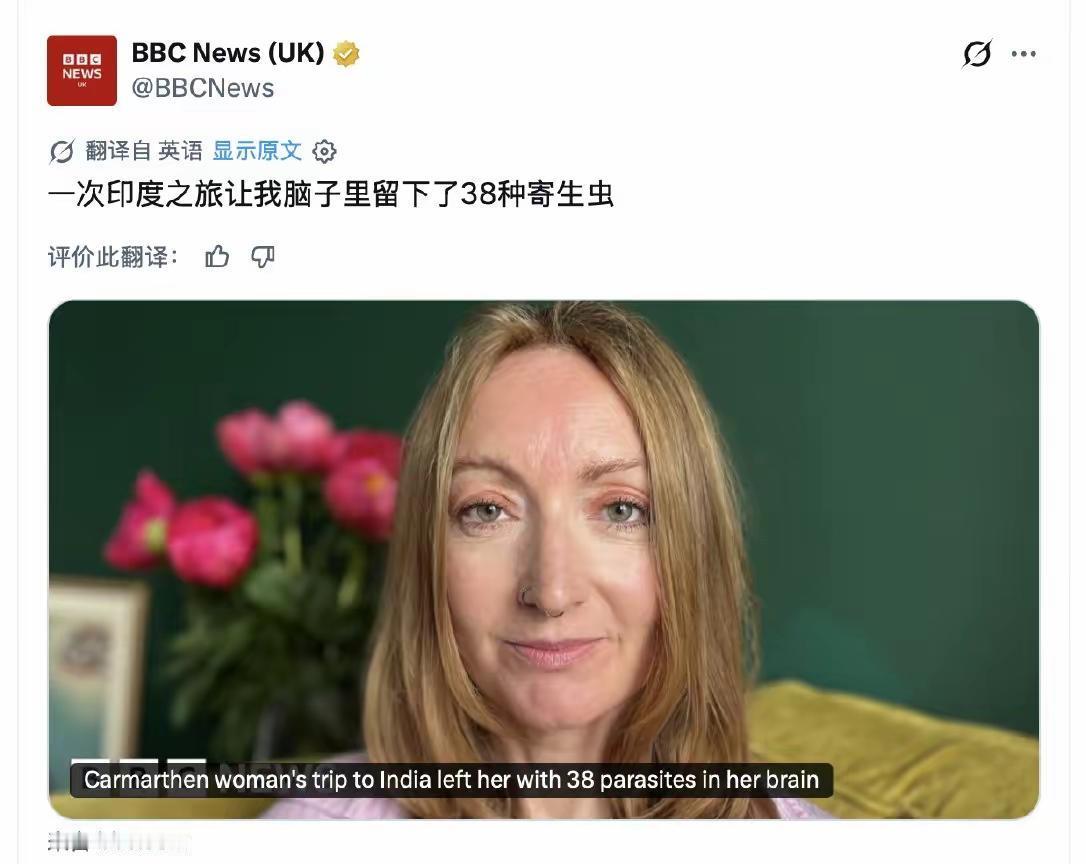 近期BBC曝光一则全球惊悚真实病例：42岁英国女子洛里·丹曼。2007年，20出