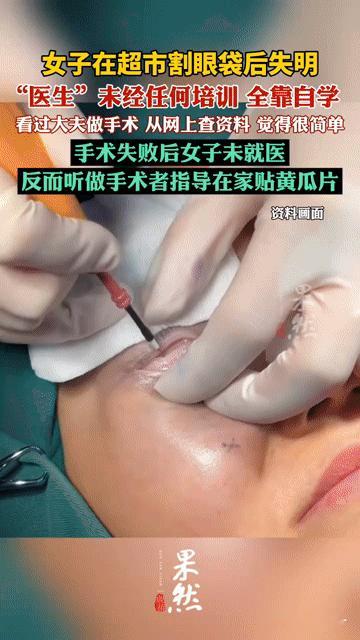超市割眼袋竟致失明！自学“医生”+黄瓜片，这教训谁看了不后怕你敢信？在超市