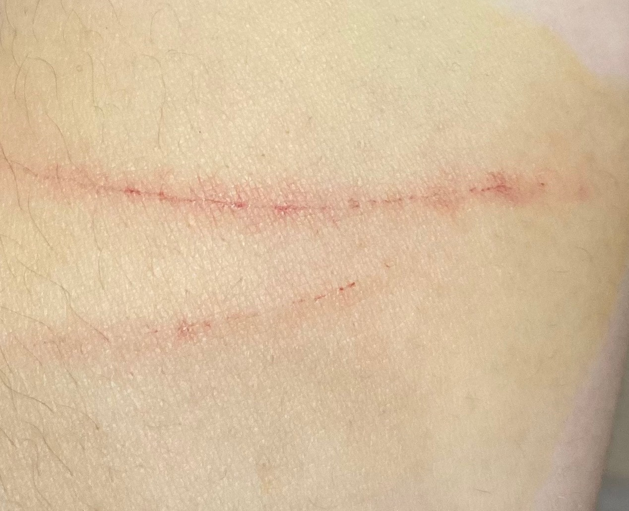 猫在被我抱着的时候闻到花露水的味道，应激了。于是我第一次真正意义上的负伤了。……