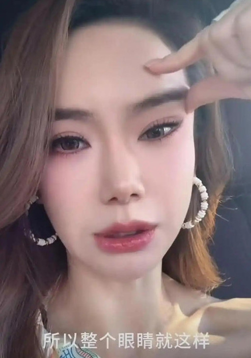 8月17日，“戚薇说打肉毒打僵了”的话题登上热搜，引发热议。近日，戚薇大大方方在