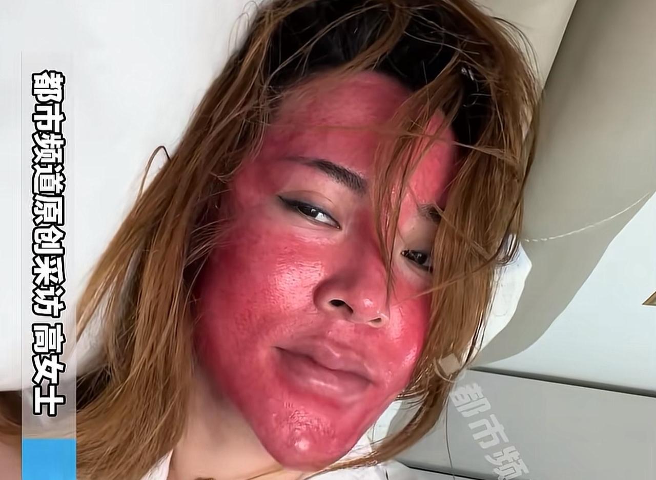 37岁一女子长期化妆不卸妆，脸红关公似的真是看不懂她了你说她懒吧，她能坚持3