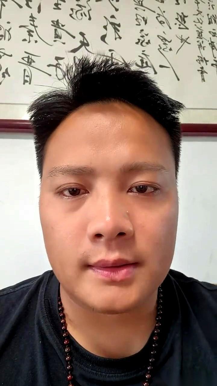 你是不是也觉得，鼻梁上那颗小痣，是点睛之笔？显得人又俏皮又娇媚。我一侄女就这么