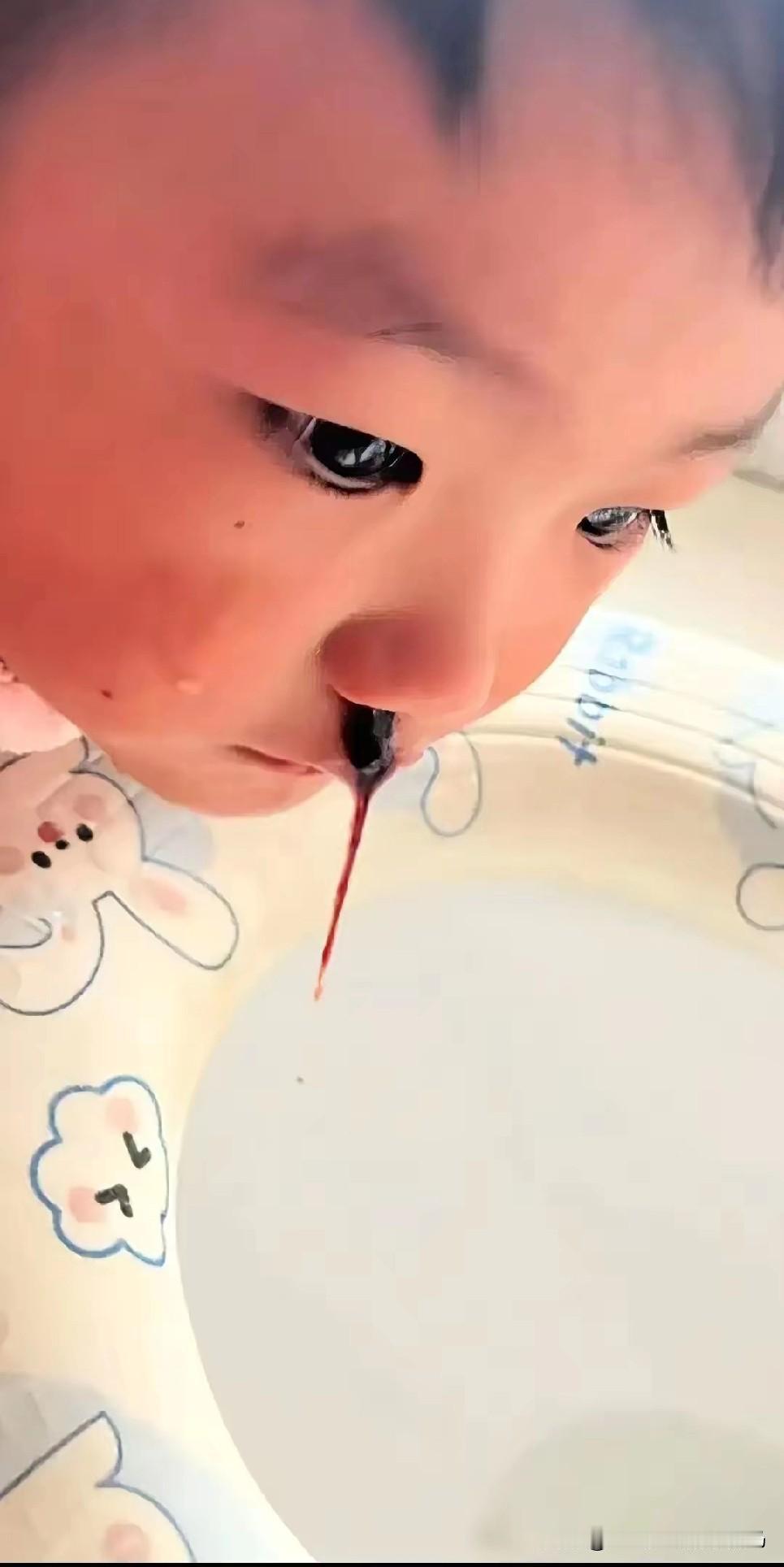 震惊了！河南周口，七岁男孩前后连着高烧，半夜枕头上全是鼻血，妈妈抱着去市里儿童医