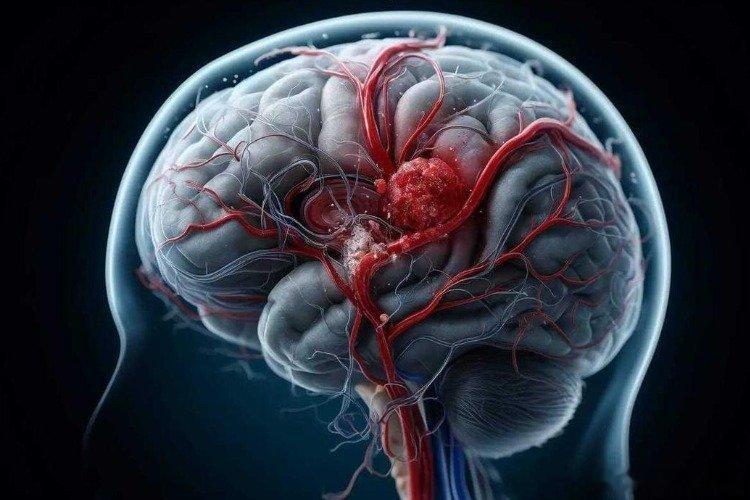 凤凰新闻【学医后才知道，脑梗前最危险的信号，不是头痛，而是“看不清”】门诊里，一