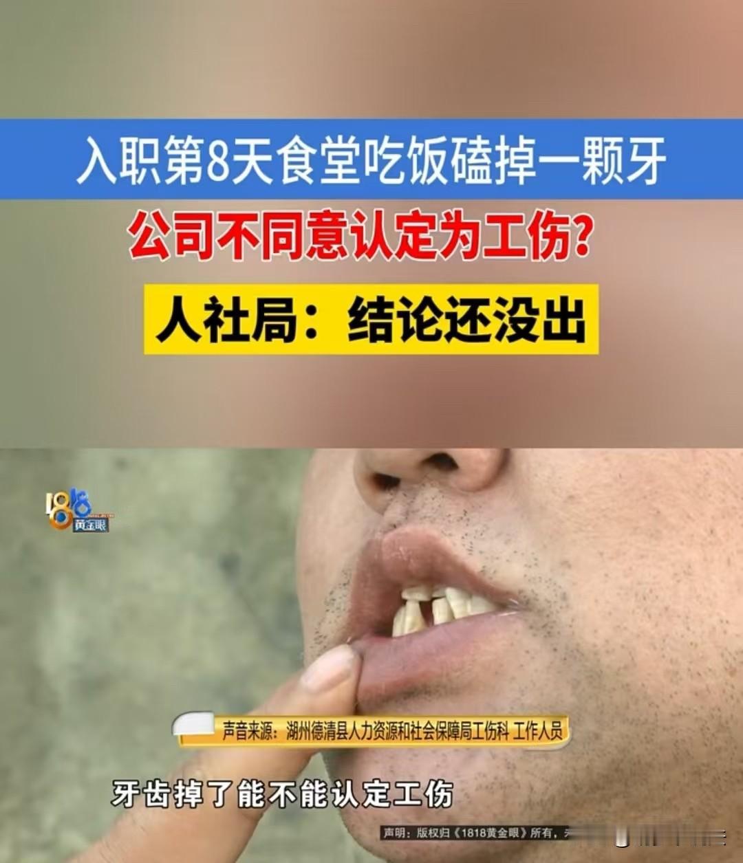 湖州，男子入职仅八天，在公司食堂吃鸭肉时，把牙齿磕掉了，他想申请工伤，可公司不愿