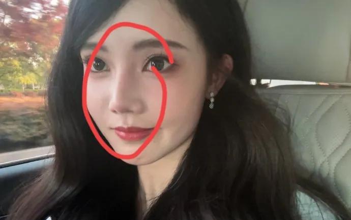 孙珍妮这个事我特意去查了一下不查不知道，一查吓一跳万万没想到她的鼻子换了，