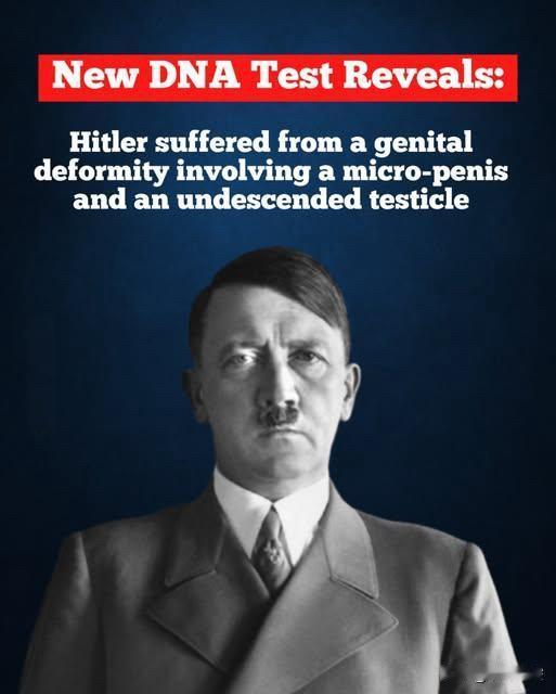 DNA揭秘：希特勒或患遗传隐疾现代DNA检测揭示，希特勒可能患有影响性发育的
