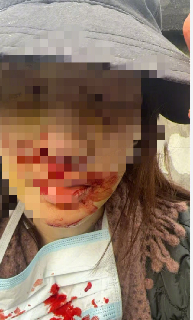 分析下金晨这件事首先，这个未就餐很重要，说明金晨肯定没喝酒第二，是因为单方面事故