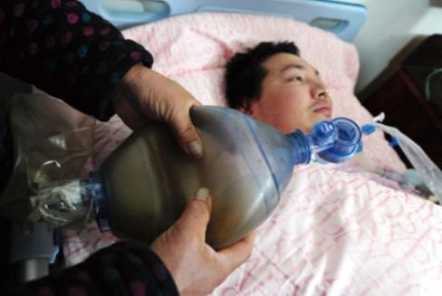 2006年，浙江一小伙因车祸永久丧失了自主呼吸功能，父母多年来捏皮球5000万次