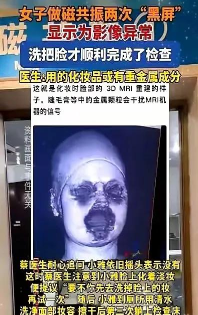 福建这事儿真的细思极恐！29岁姑娘头晕做核磁共振几千万的精密仪器直接“失