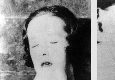 工人涂夜光漆下巴竟碎了---**