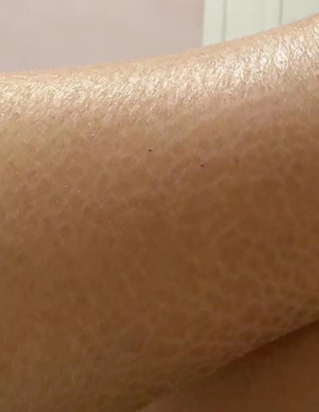 肾病来临之前，还是有点迹象的。口唇干，皮肤干燥，严重的长鳞片。小便不爽快，容易