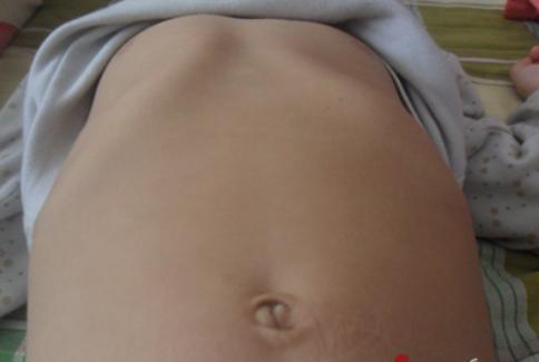 婴幼儿时期忽视了这种营养要素, 容易导致宝宝鸡胸, 妈妈别大意了