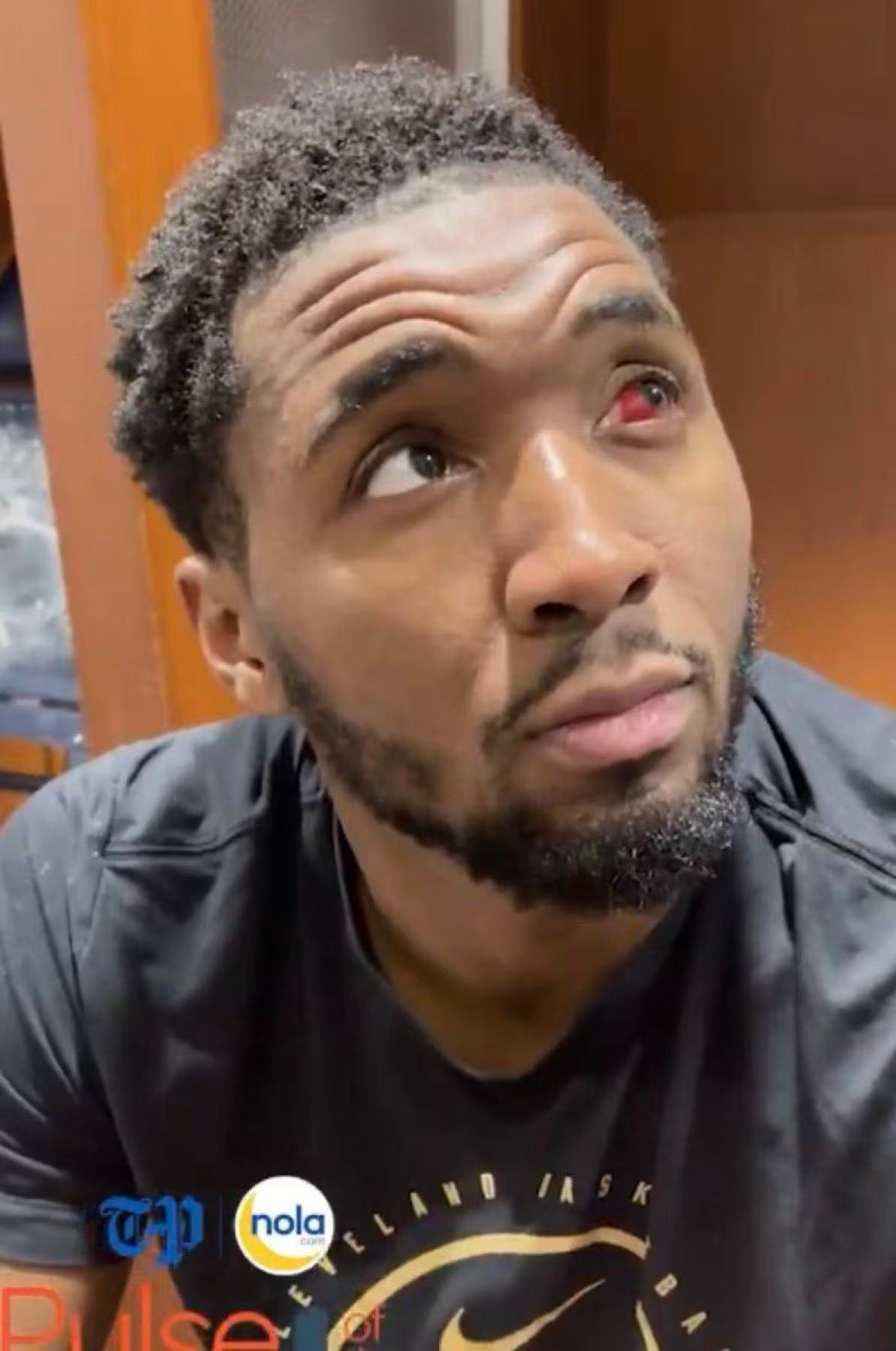 “血轮眼”组合