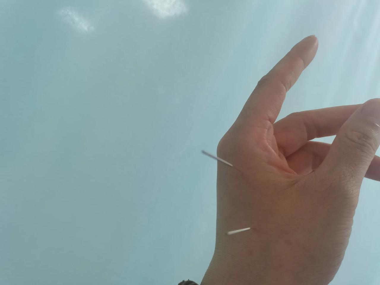 腰间盘真是熬人呀，欲哭无泪。针灸➕吃药，一直都没有好利索，稍微累点就开始腰疼了
