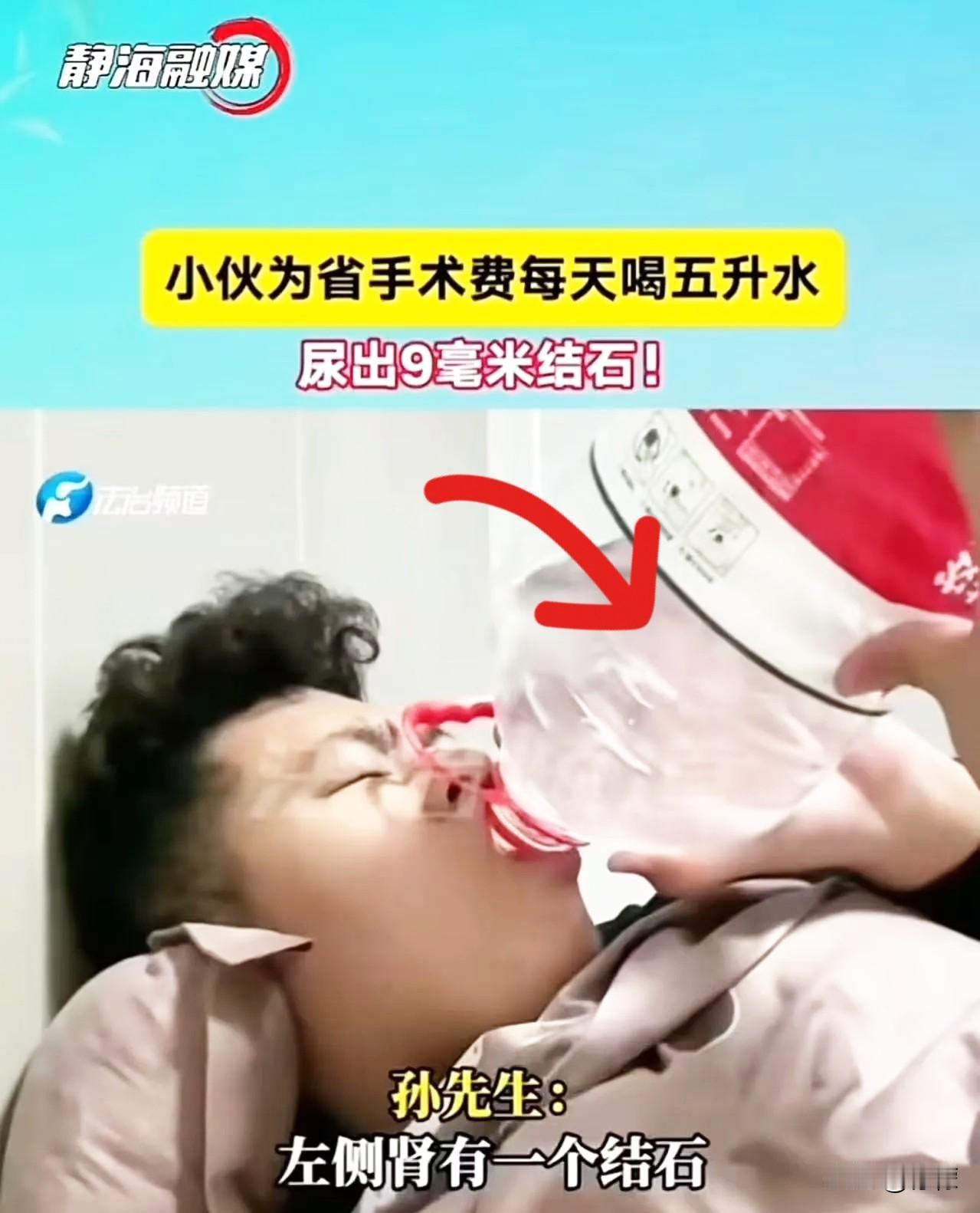 真是一个狠人啊！小伙为了省12000手术费，每天喝五升水，结果尿出9毫米结石