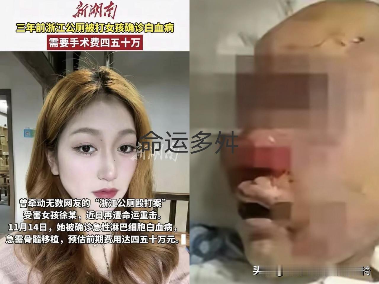 谁能想到，上个公厕竟成了20岁女孩徐某一生的噩梦！更让人窒息的是，三年前的暴力