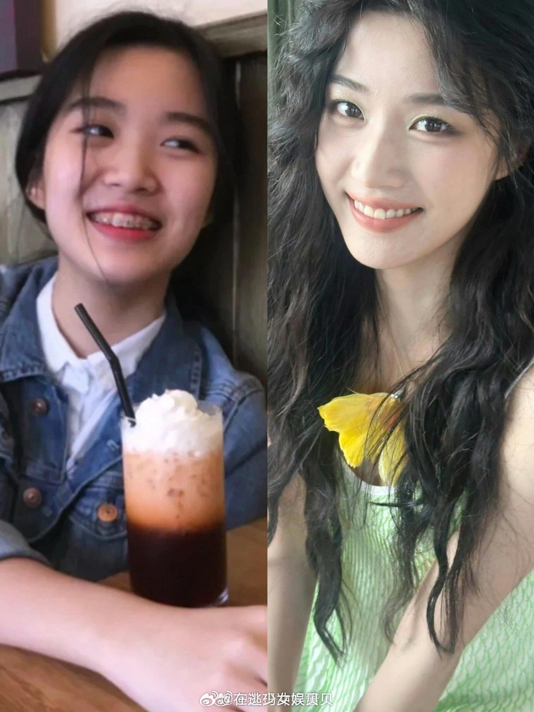 父母是牙医就会重视小孩的牙齿矫正吗？