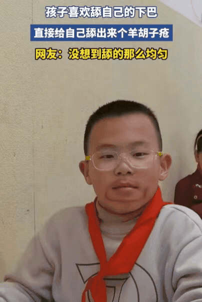 笑不活！浙江一男孩喜欢舔自己下巴，家长也没在意，觉得就是小孩闲得慌，结果，过一段