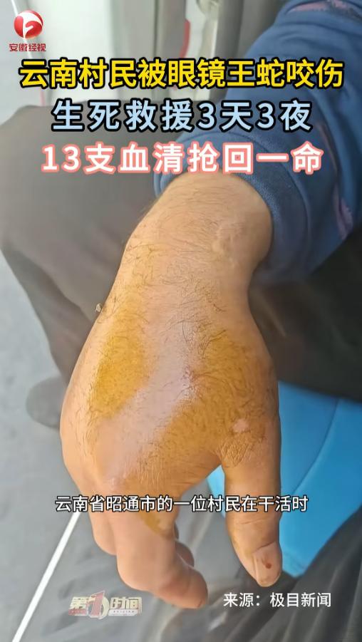 “这得多大的心理阴影啊！”5月11日报道，云南昭通，一村民在地里干活时，被一条大