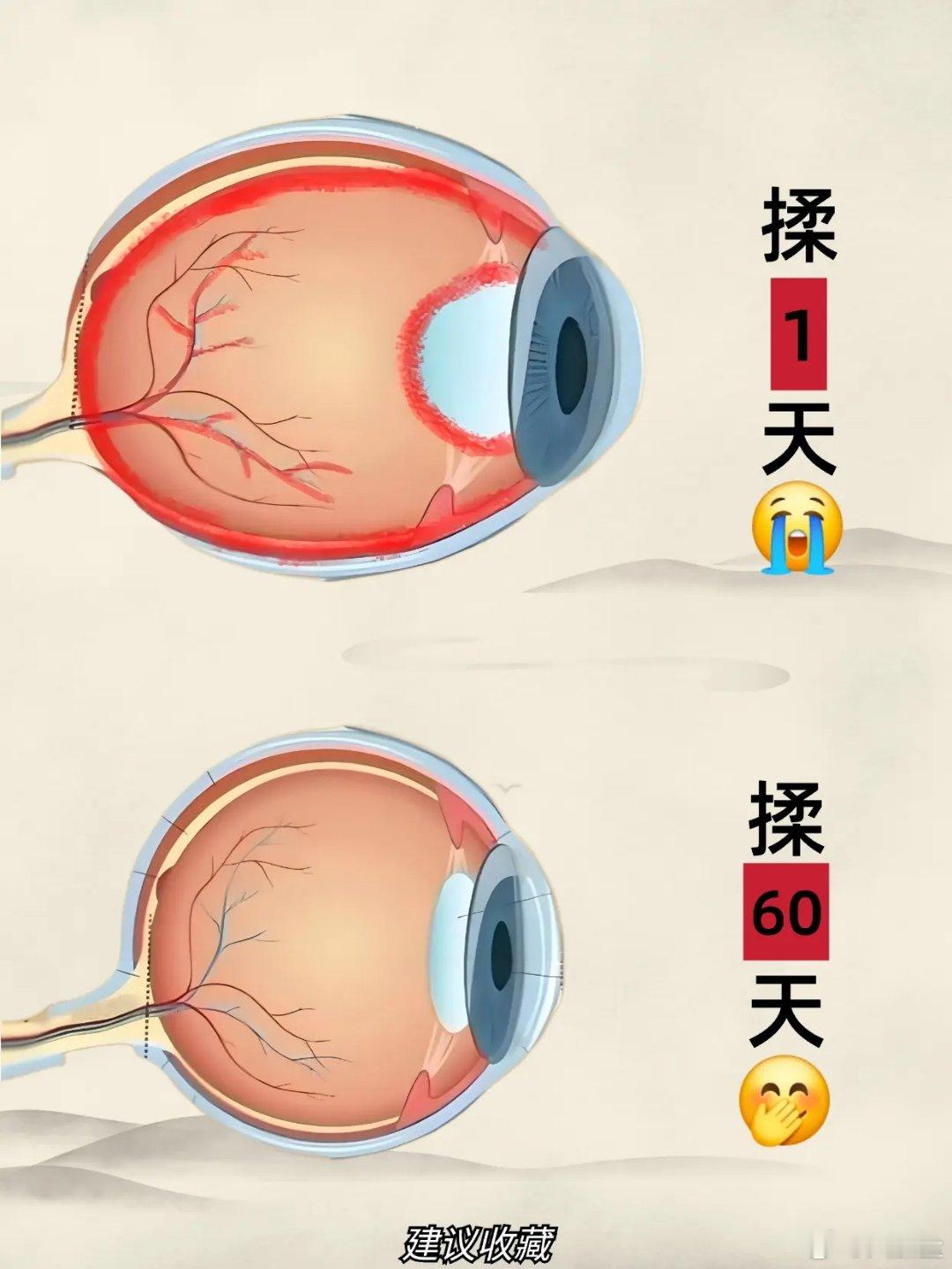 高度近视还得是揉天筋啊！！！高度近视日常怎么做1．远眺远眺最好是看5米以外的参照