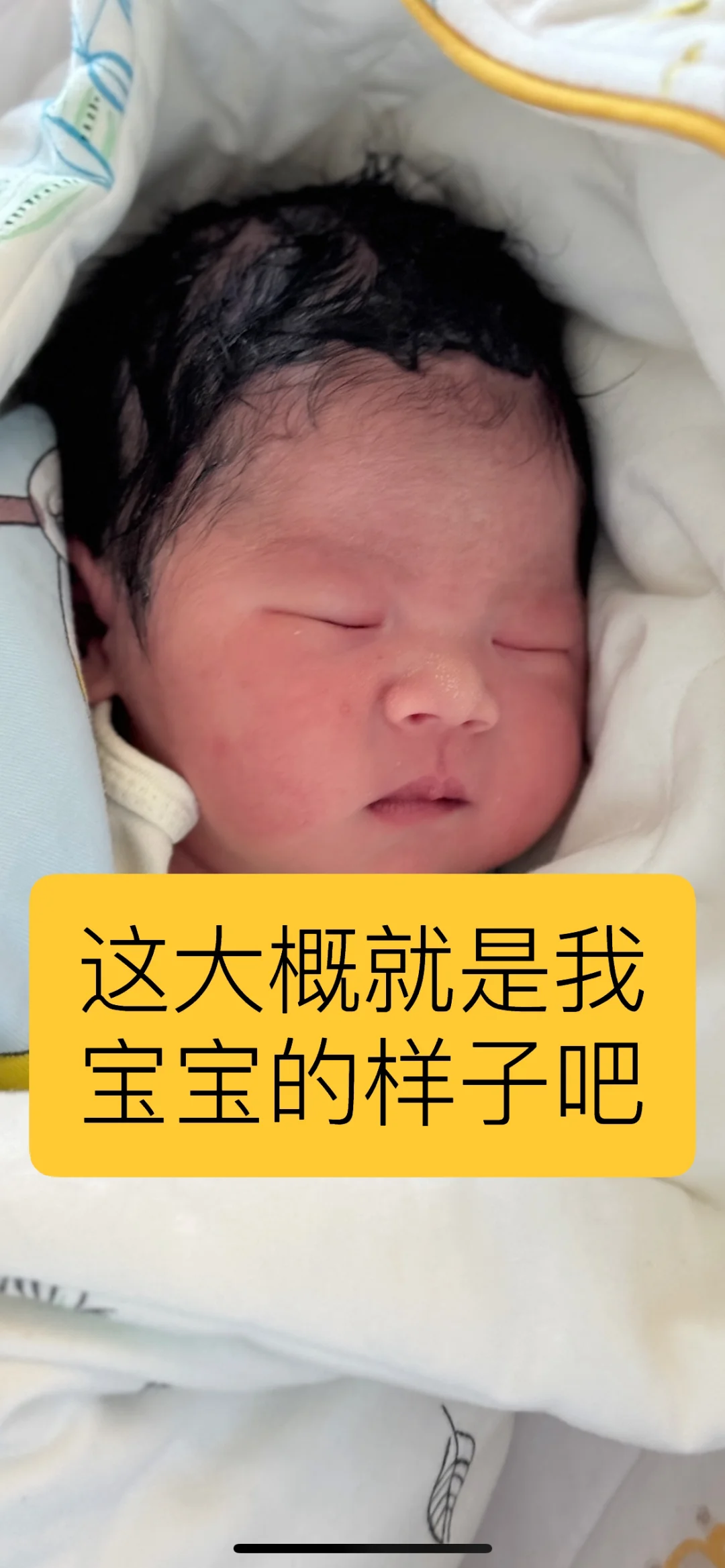 住院准备生产了