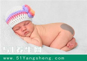 知道“胎记”是怎么来的吗? 是孕妈们孕期的一些不良行为而导致的