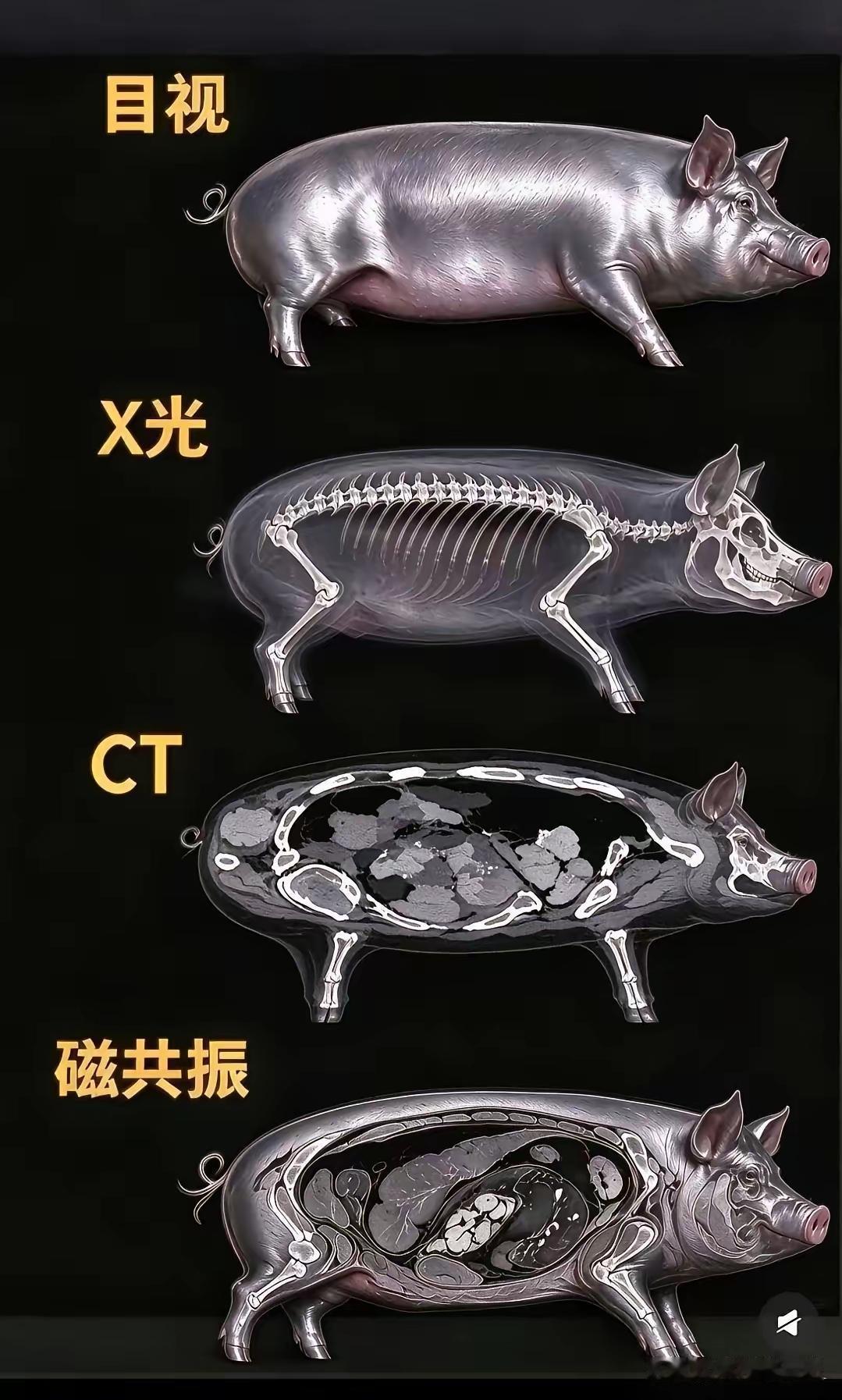 为什么核磁共振这么贵？一看便知道了！前阵子我妈突然头晕，去医院检查，医生建