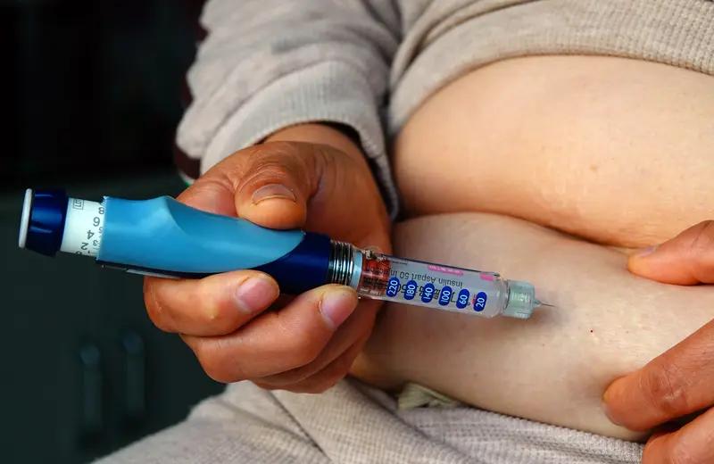 跑步跑了5年糖尿病能好吗？答案是不能。糖尿病是因胰岛细胞、胰岛素受体等异常导致的