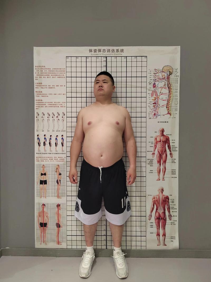 网红减肥法“坑”人！男子狂瘦50斤后痛风来袭一男子为快速变瘦，采用网红减肥法