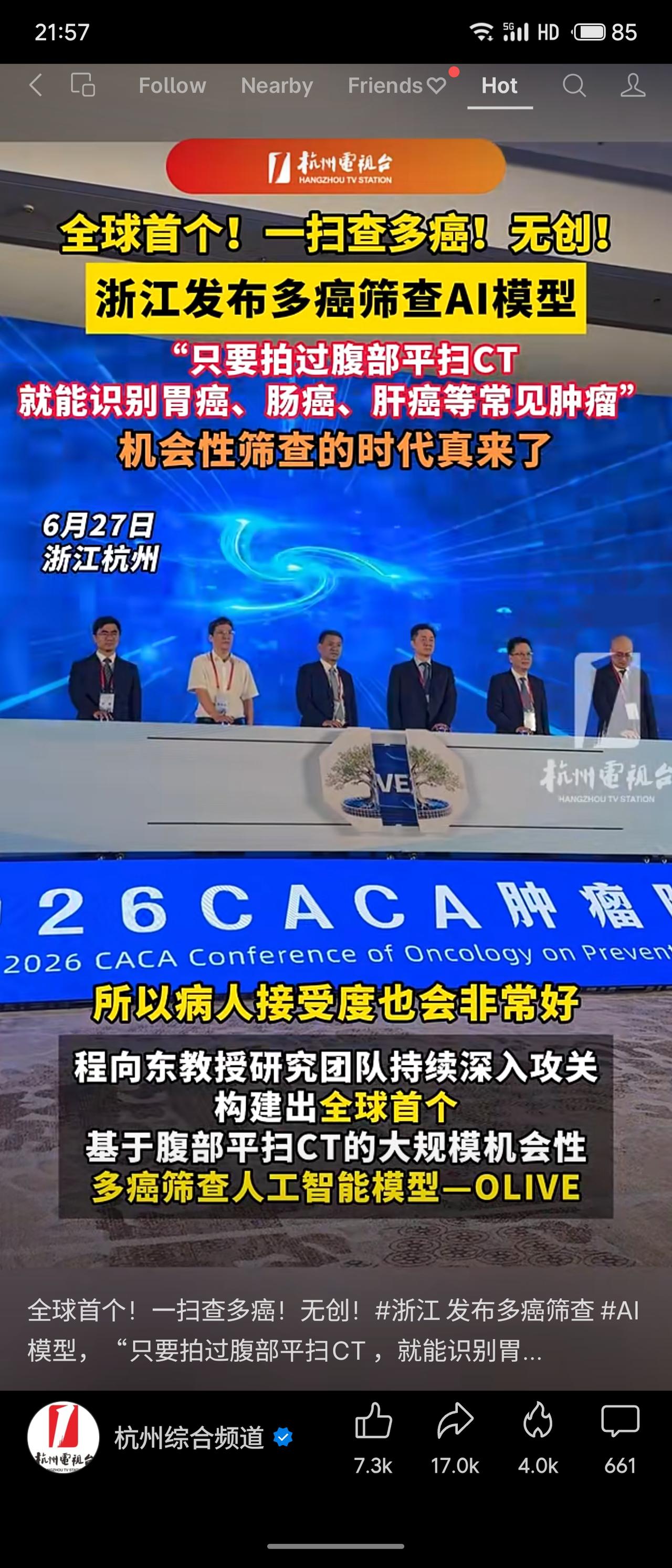 浙江发布全球首个多癌筛查AI模型“OLIVE”，基于腹部平扫CT，无需造影剂或额