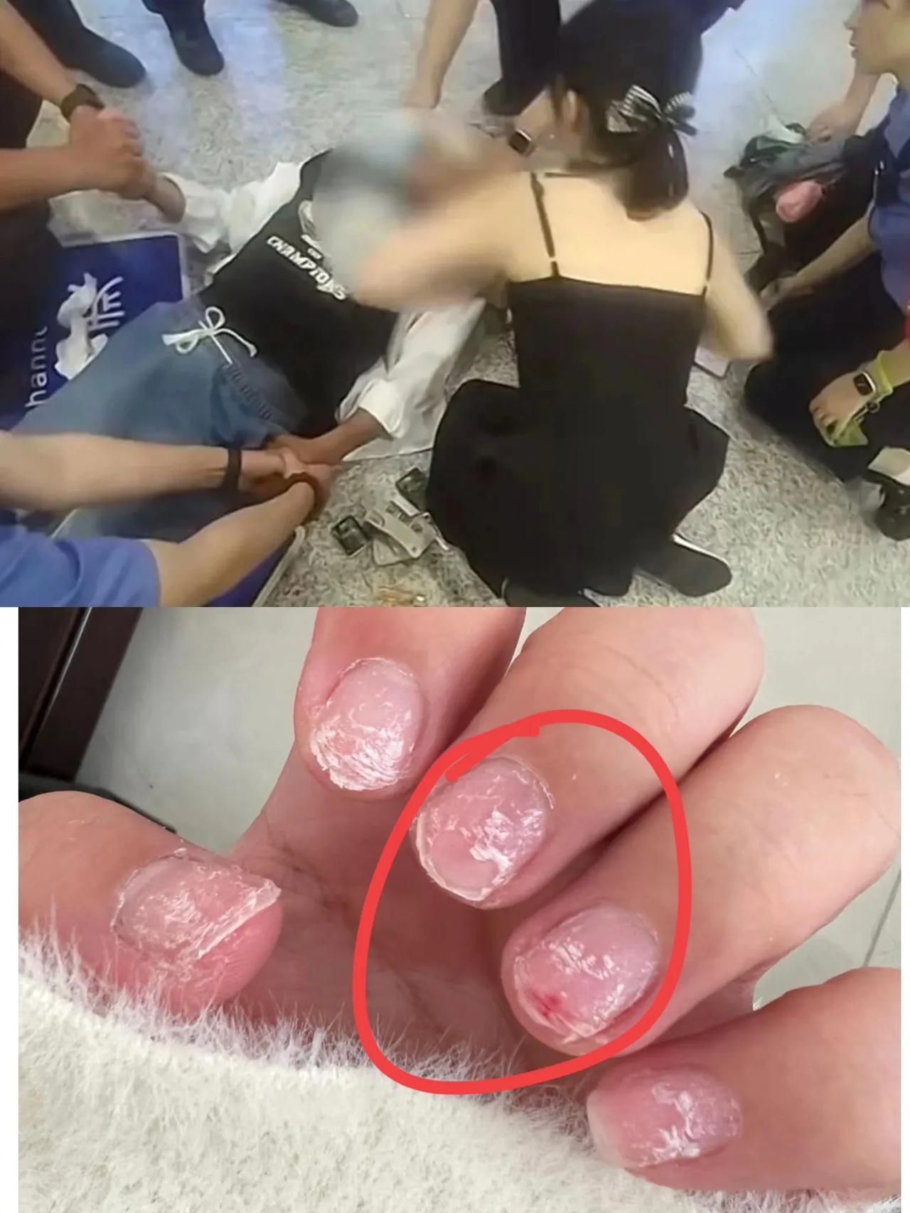 我老公不明白，只是急救了一个病人，这护士为啥一下子就火了？我说，你看看强力卸
