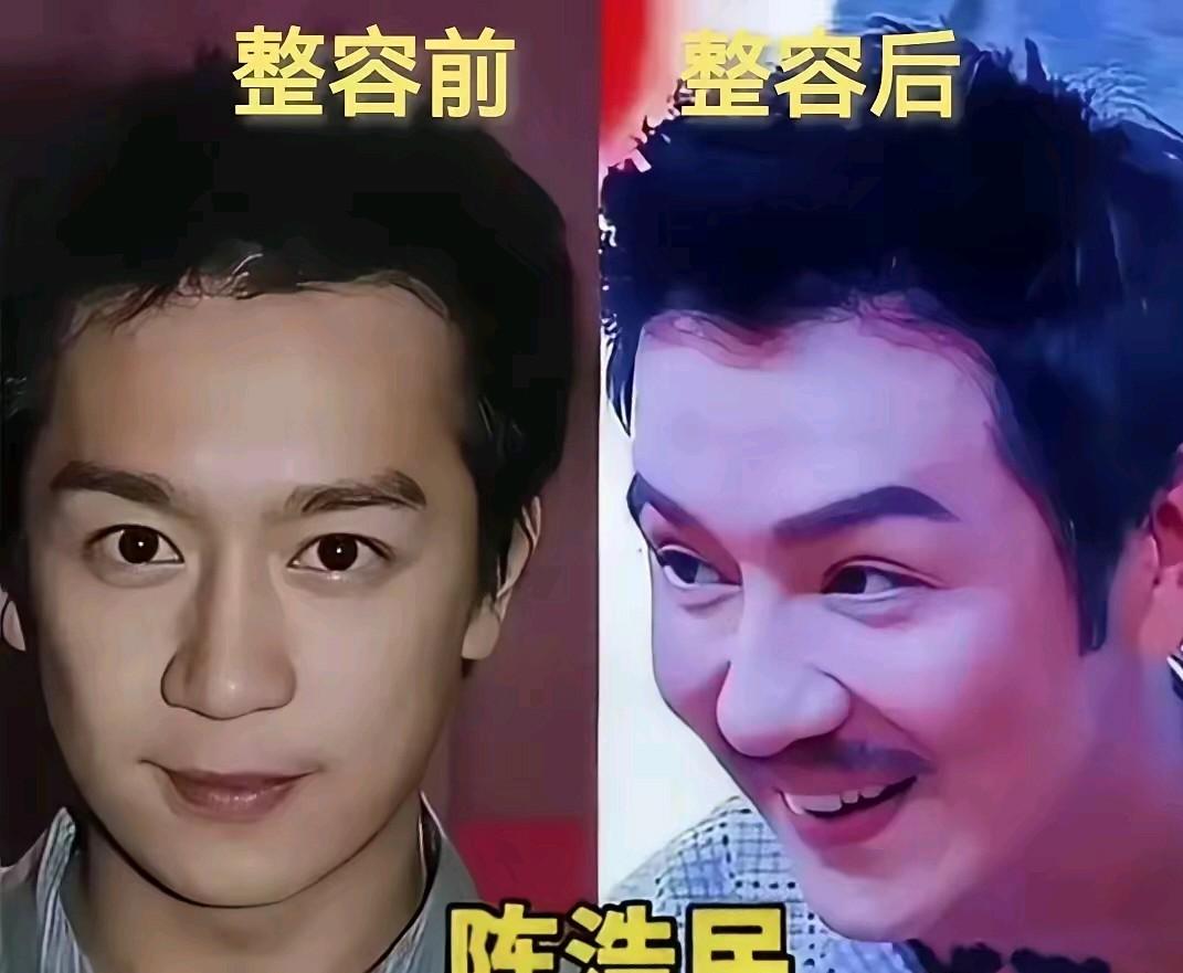 盘点哪些整容失败的男明星，在影视圈整容失败的当属以下几位了，陈浩民，苏有朋，刘恺