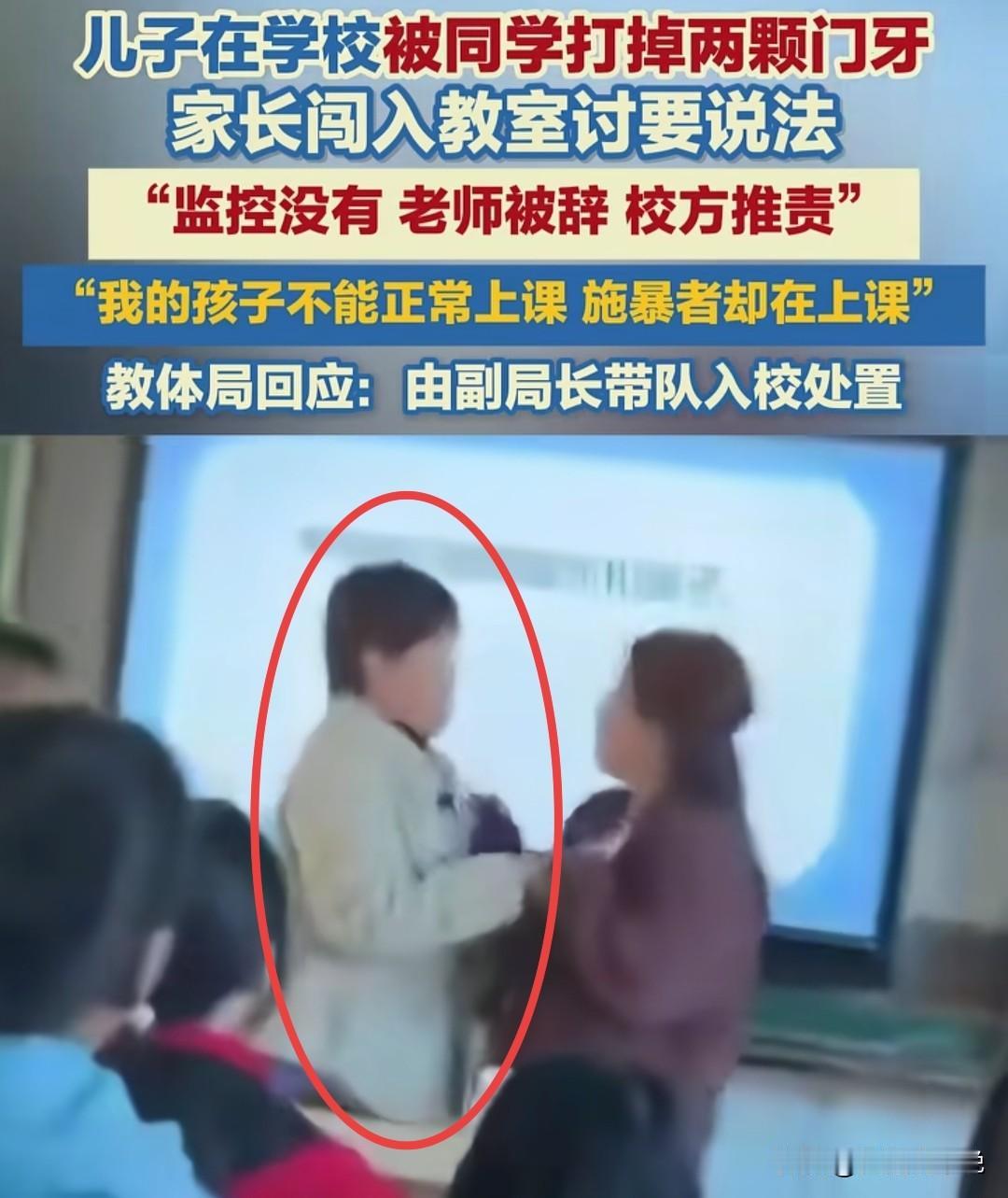 这个学校的领导应该好好检讨一下，学生在学校被打掉门牙，学校不积极协调双方家长处理