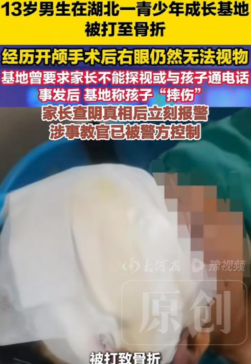 这孩子也太惨了。江西九江13岁的张浩，被送进湖北某“青少年成长基地”之前，父亲反