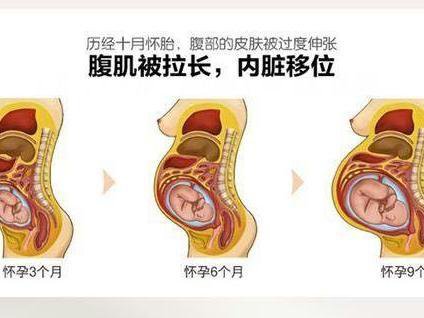 一起来做好充分准备,迎接胎宝宝的到来 1,水肿 到了孕晚期,许多孕妇的