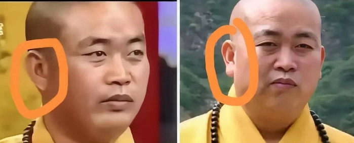 释永信的耳垂是假的？网友说这是打了玻尿酸为什么这样子说呢有网友扒出释永信