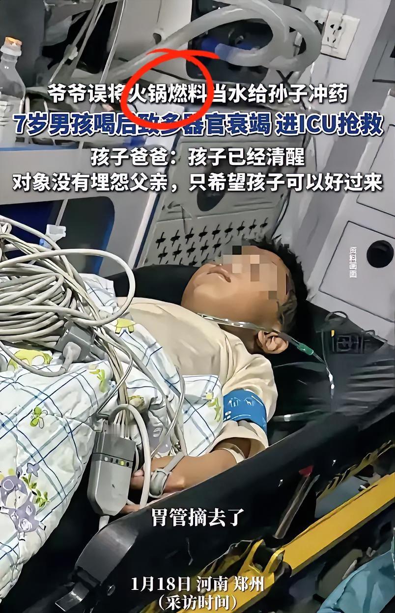 误饮矿物燃料的男孩已经醒了，但情况不容乐观，胃管拔了，意识也已恢复，只有肾