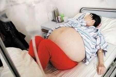 年轻孕妈刨腹产五胞胎, 孩子的性别很惊喜