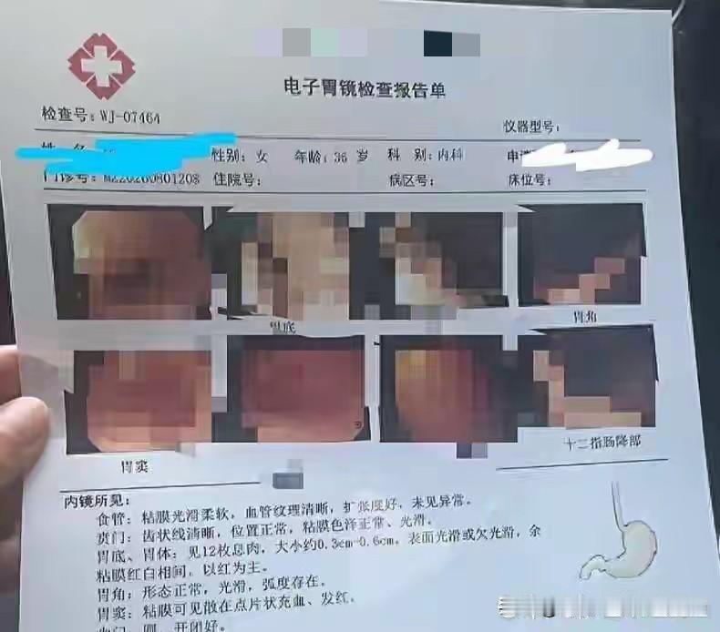 这是被做局了？辽宁沈阳，女子陪着丈夫去体检，闲来无事，顺便做了一个胃镜。结果医生