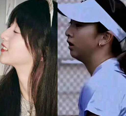 田亮女儿森碟下巴后缩矫正好了，这个风一样的女子现在好美好美！2026年，田亮叶